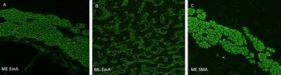 Primate liver tissue substrate in indirect immunofluorescence diagnostics for patients with dermatitis herpetiformis and celiac disease